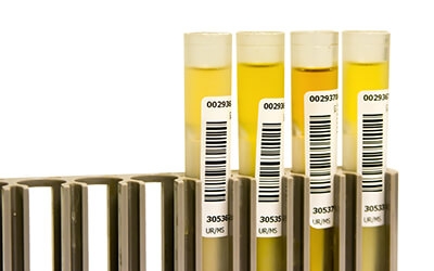 Drug and Alcohol Screening Test Tubes